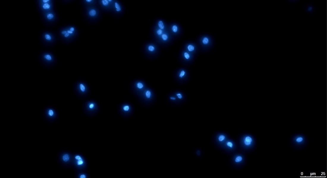 Fluorescence microscopy image of chicken liver cells. The cell nucleus has been stained in blue, where the DNA is packed. Scale size at bottom right.